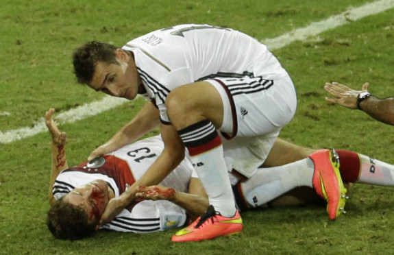 Germany's Thomas Mueller, right, is attended by his teammate Miroslav Klose after suffering a injury during the group G World Cup soccer match between Germany and Ghana at the Arena Castelao in Fortaleza, Brazil, Saturday, June 21, 2014. (AP Photo/Themba Hadebe)